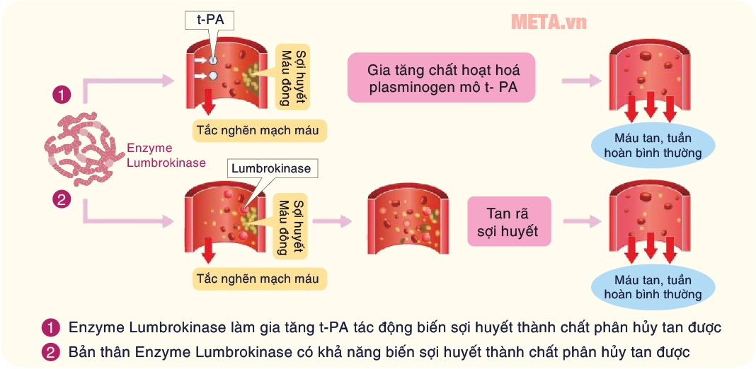 Viên uống phòng ngừa đột quỵ