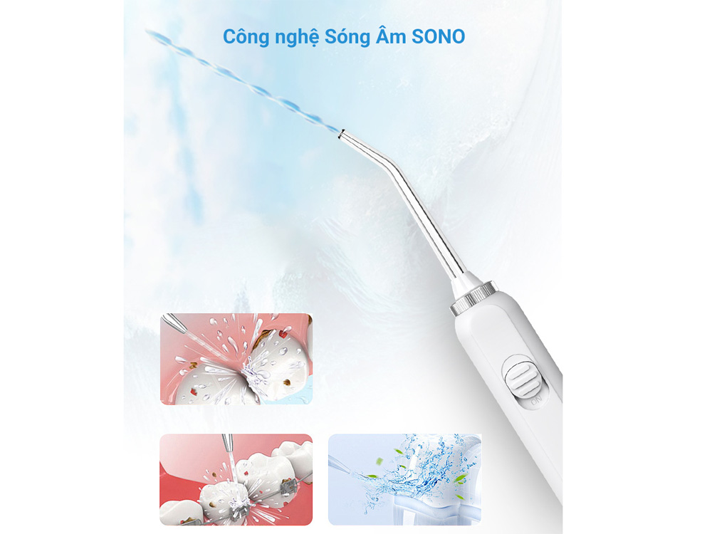 Công nghệ Sono hỗ trợ làm sạch khoang miệng toàn diện