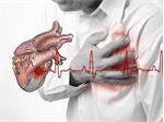 Nhồi máu cơ tim và những điều bạn nên biết