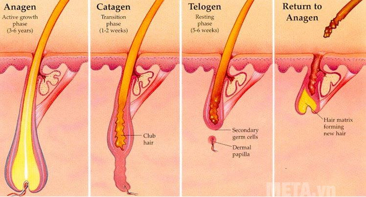 Triệt lông IPL Triệt lông IPL