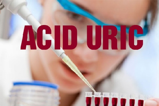 acid uric 