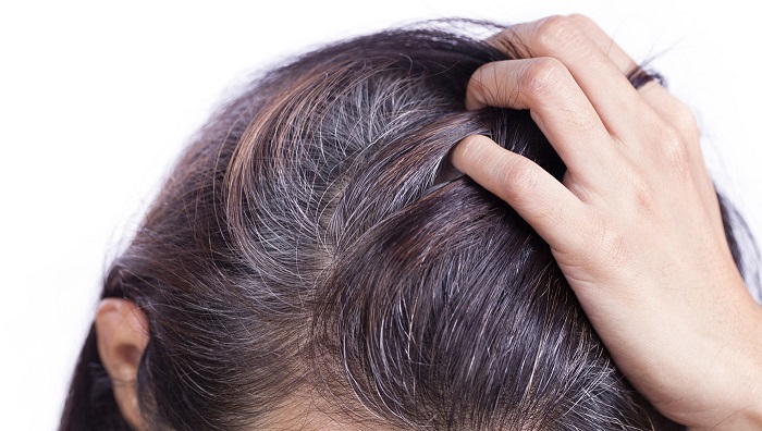 Nguyên nhân tóc bạc sớm ở người trẻ tuổi