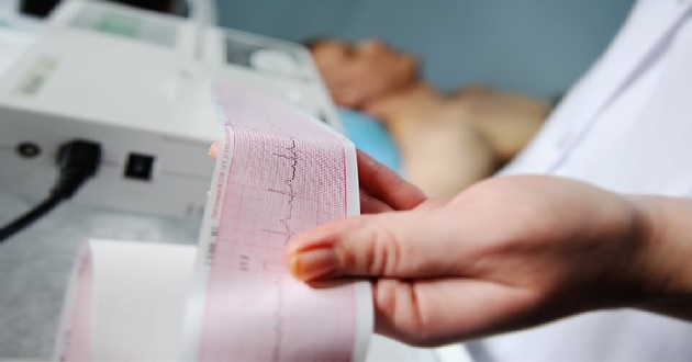 ECG cơ bản