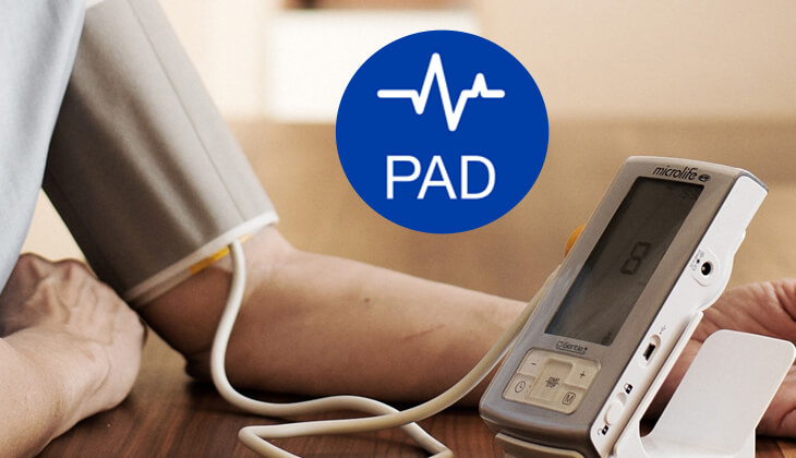 Công nghệ PAD trong máy đo huyết áp