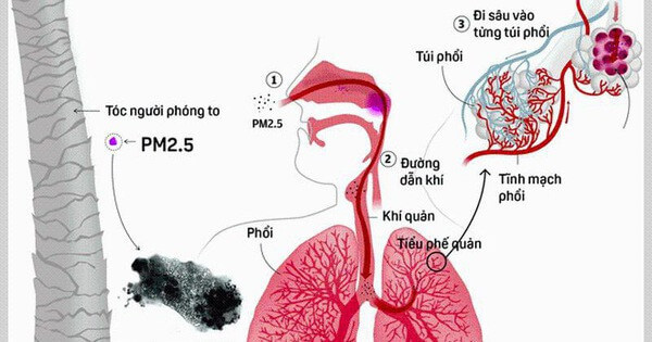 Không khí ô nhiễm chứa nhiều bụi mịn ảnh hưởng đến sức khỏe